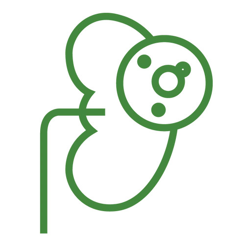 Prevencia močových kameňov